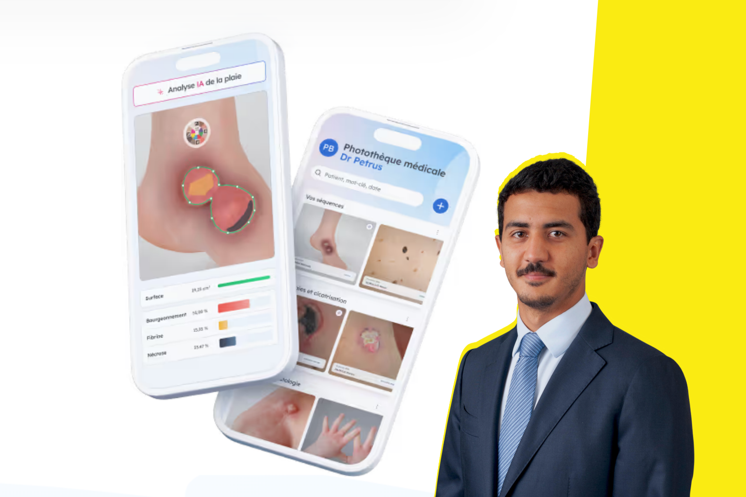 « Avant, on mélangeait les photos de vacances et celles des cicatrices des patients » : Pixacare s'installe au CHU de Rennes