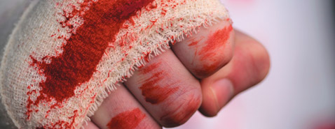 Saison I, épisode 1 : L’Attaque Ordinale