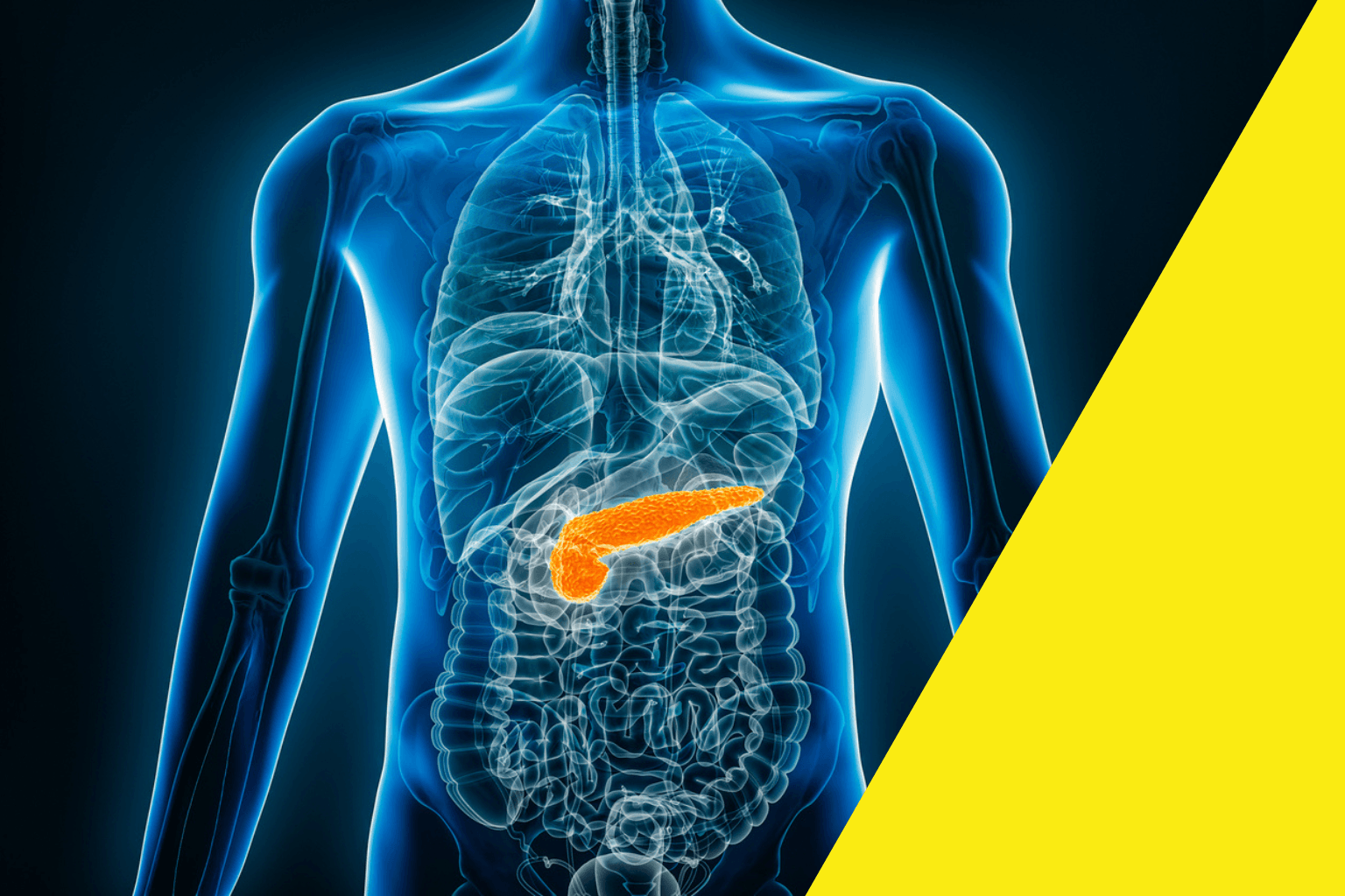 Après un long point mort, de nouvelles pistes pour améliorer la survie dans le cancer du pancréas 