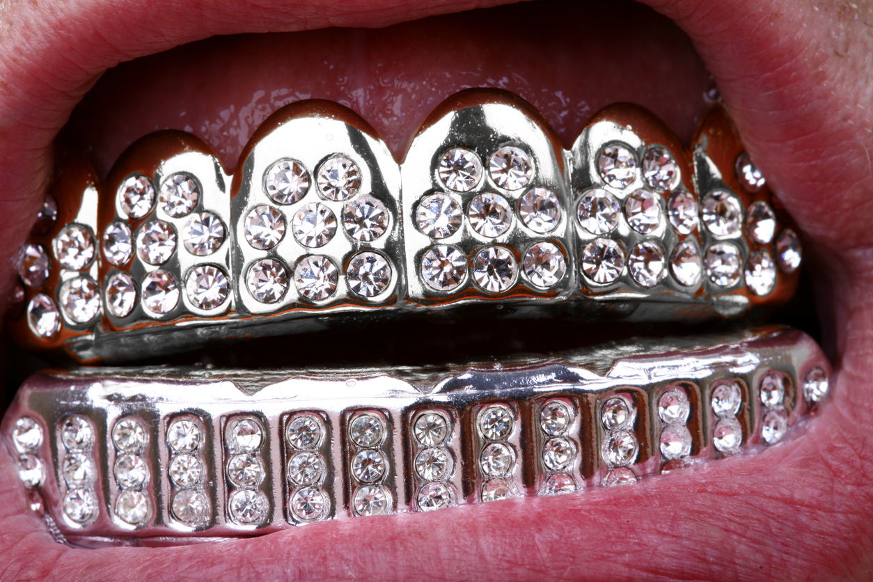 Il promettait un « sourire de star » et a mutilé des centaines de patients. Le dentiste le mieux payé de France (80 000€/mois) au tribunal