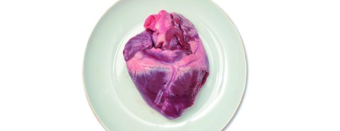 L'anatomopathologie a la part belle aux HCL !