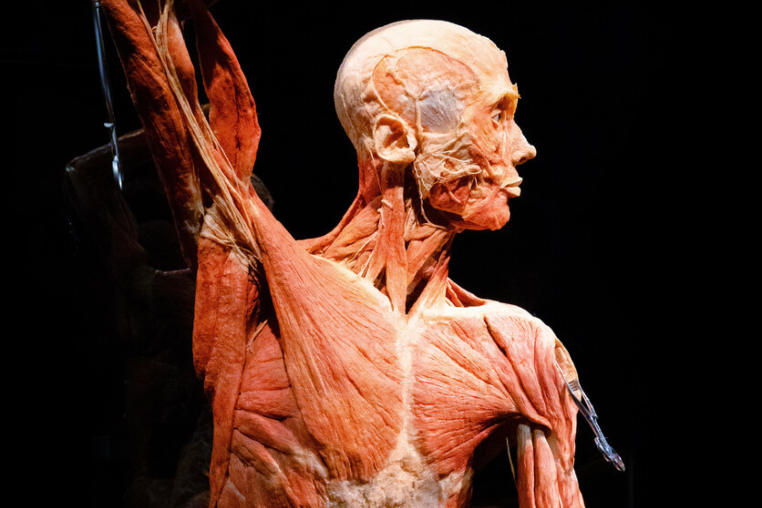 Dr Gunther von Hagens, créateur des expositions de cadavres et de la plastination, est décédé