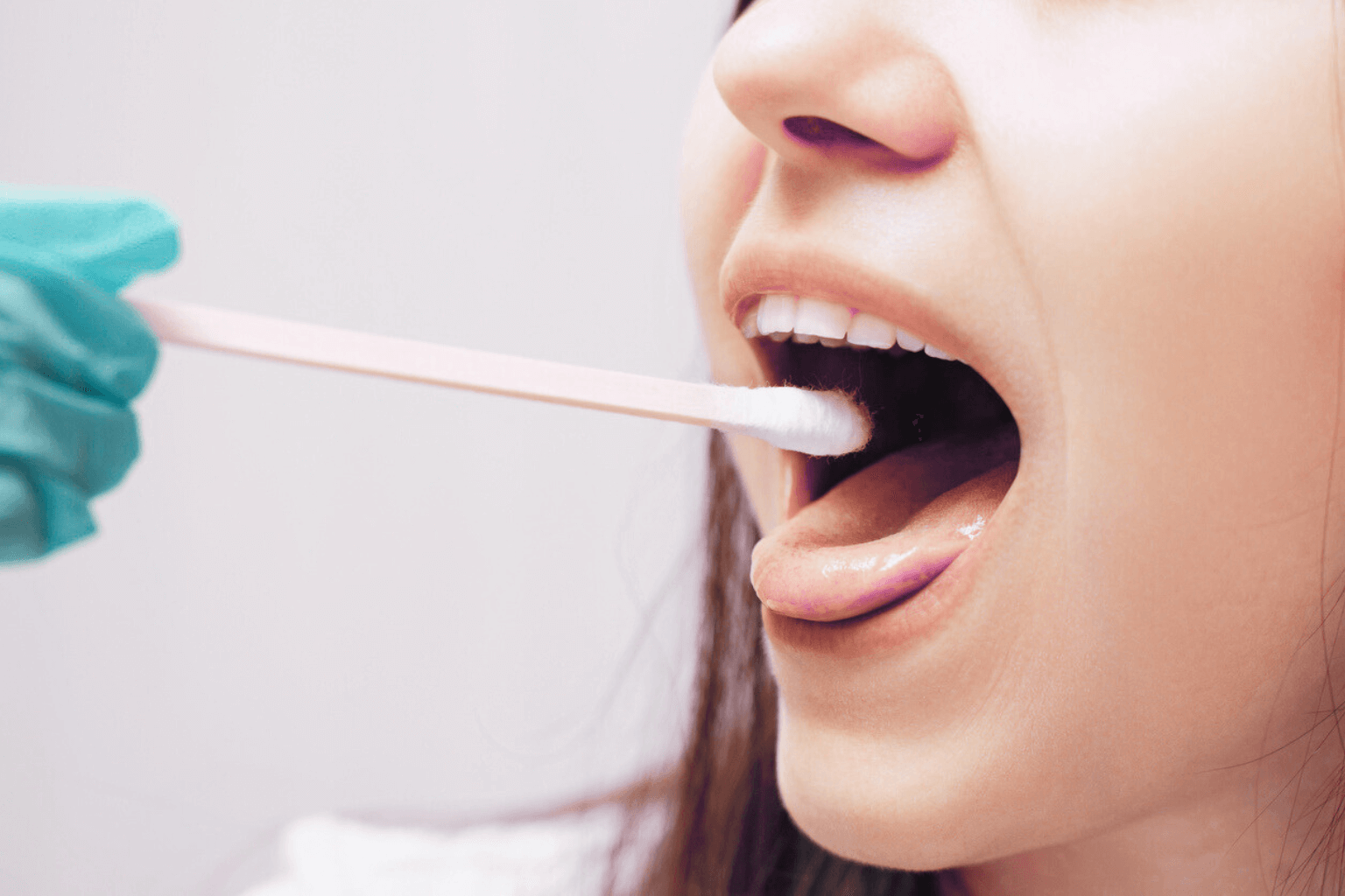 Test salivaire pour diagnostiquer l'endométriose : à quand le remboursement pour toutes ? 