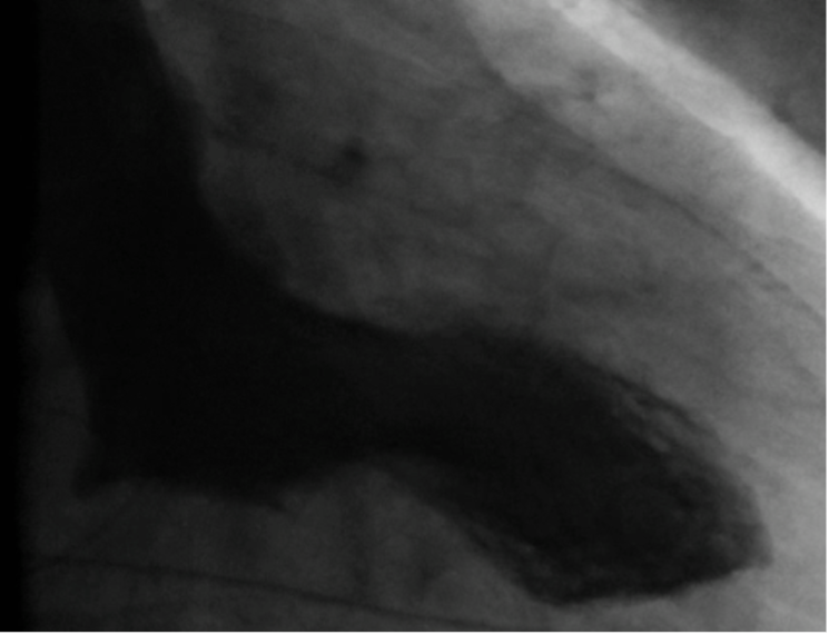 Image B