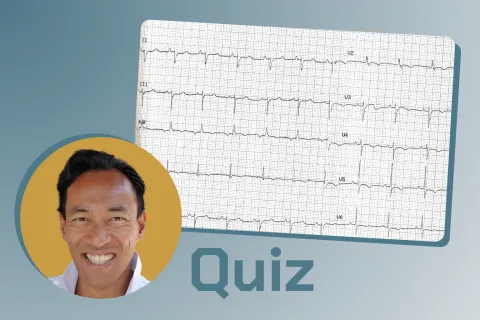 Le Quiz Cardiologie du Dr Sok Sithikun Bun : Quel est le diagnostic de cet enfant ? 