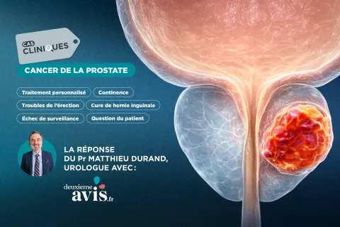 Cas clinique en urologie du Pr Matthieu Durand : quelle stratégie locale pour ce cancer de la prostate après 9 ans de surveillance active ?