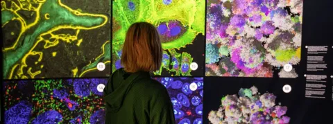 ‘Cancers‘, une grande expo à Paris à prescrire à vos patients… ou à vous-même