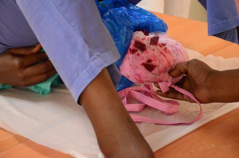 Betteraves bouillies dans un sac plastique