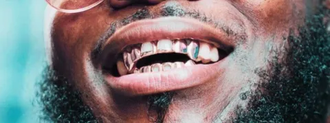 Le dentiste le mieux payé de France (80 000€ par mois), ou boucher de Marseille, épilogue judiciaire vendredi