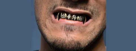 Le « dentiste le mieux payé de France » ou « boucher de Marseille » ne s’est pas présenté à l’ouverture de son procès en appel