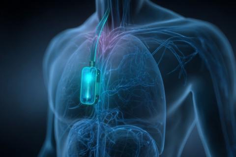 Diabète : un mini-implant libère du glucagon en cas d’urgence