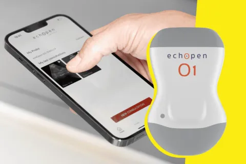 Dr Mehdi Benchoufi a développé un échographe portable, accessible à toutes les spécialités et peu coûteux : « Nous avons conçu l’outil comme le stéthoscope du XXIe siècle »