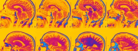 Neurosciences et droit : peut-on détecter le mensonge grâce à l’imagerie médicale ?