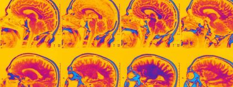 Neurosciences et droit : peut-on détecter le mensonge grâce à l’imagerie médicale ?