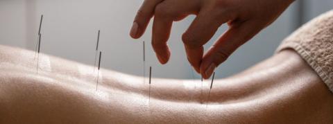 Initiation à l'acupuncture médicale, un DIU qui pique notre curiosité
