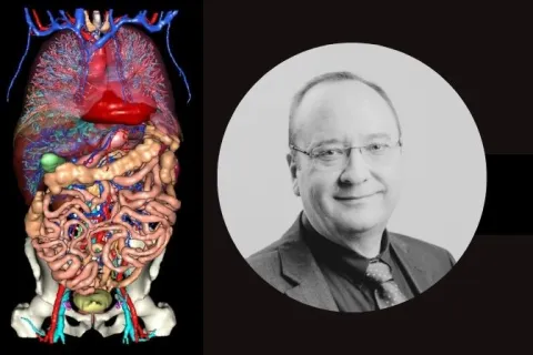 Pr Luc Soler : « Visible Patient Lab fournit une cartographie 3D qui optimise la chirurgie en réduisant les complications, le temps opératoire et les récidives tumorales »