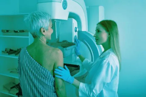 Les mammographies moins utiles à la suite d’un cancer du sein après 50 ans ? 