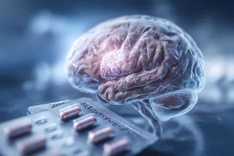 Progestatifs à risque : 5 ans de vigilance et 90 % de méningiomes évités