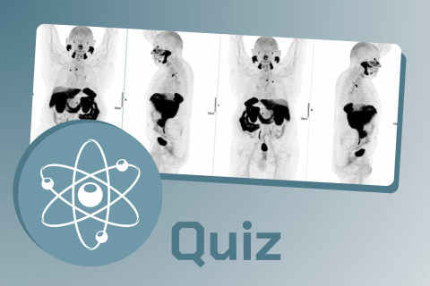 Le Quiz de Médecine nucléaire du Dr Aurélie Schiazza : De quel examen de médecine nucléaire s’agit-il ?