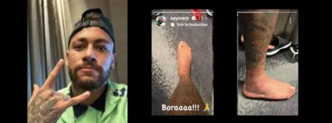 Neymar Jr, opéré aujourd’hui, qui est le chirurgien qui tient entre ses mains la santé du joueur le plus cher du monde ?