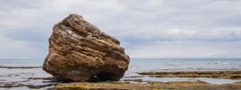 Record du monde : un calcul rénal de 801 grammes retiré au Sri Lanka