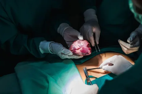 Transplantation cardiaque : Comment augmenter le nombre de greffons disponibles ?
