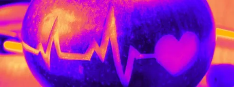 Un Français sur trois est touché par l’hypertension... et un sur deux l’ignore