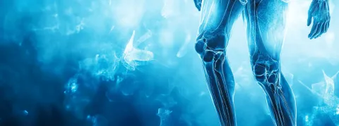 La personnalisation au cœur des nouvelles recommandations de la prise en charge de l'arthrose du genou