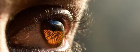 La triple épidémie en déclin... et si la variole du singe signait son retour ?