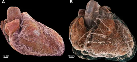 La première cartographie 3D de cœurs jusqu'à l'échelle cellulaire a été publiée… et c’est grâce à une technologie française !