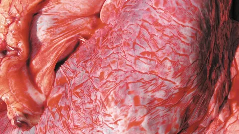 Absence de diagnostic