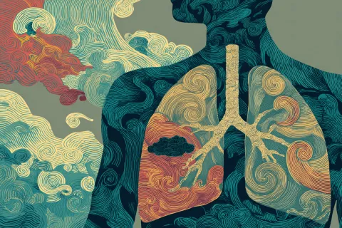 Asthme sévère et polypose naso-sinusienne : Feu vert européen pour la biothérapie longue durée de GSK