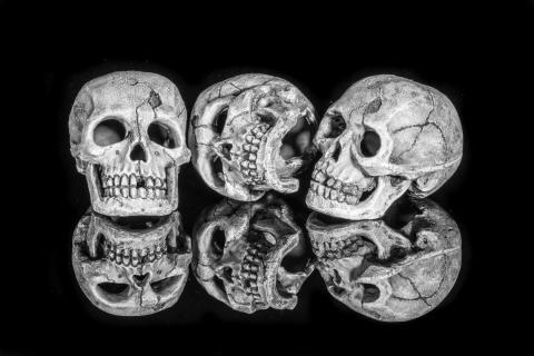 L'Université de médecine de Strasbourg fait la lumière sur son passé nazi