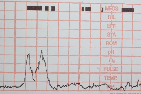 Covid-19 : Un coup de gueule, suivi de l’attente 