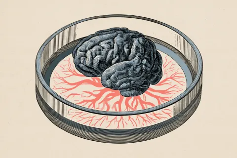 Des ébauches de cerveau cultivées en laboratoire pour mieux comprendre le glioblastome
