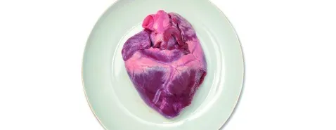 L’anatomopathologie a la part belle aux HCL !