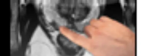 Précis d'Anat' estival