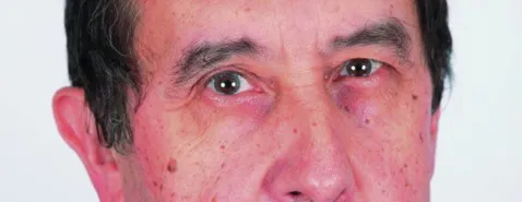 Le remplacement est une chance !