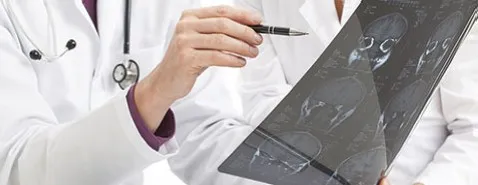 La neurologie évitée au CHU de Nice