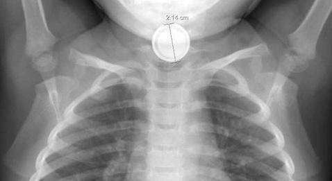 Urgences : le miel à la rescousse