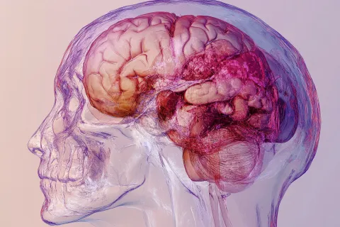 Progestatifs à risque : 97 % de prescriptions en moins, 90 % de méningiomes en moins