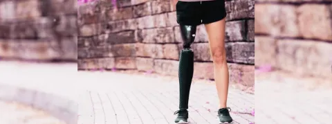 Face à l'inflation, les orthoprothésistes réclament la mise à jour de leurs tarifs