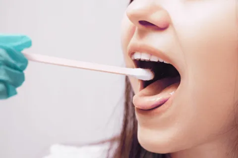 Test salivaire pour diagnostiquer l'endométriose : à quand le remboursement pour toutes ? 