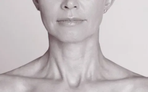 Fiasco des greffes de trachée : un chirurgien italien déchu au tribunal en Suède