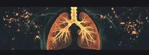 2023, une année record pour la tuberculose : plus de 8 millions de nouveaux cas dans le monde