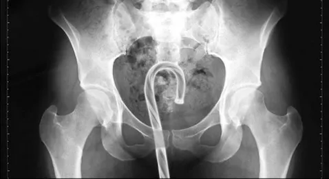 L'algorithme-diagnostic du Dr WUDson