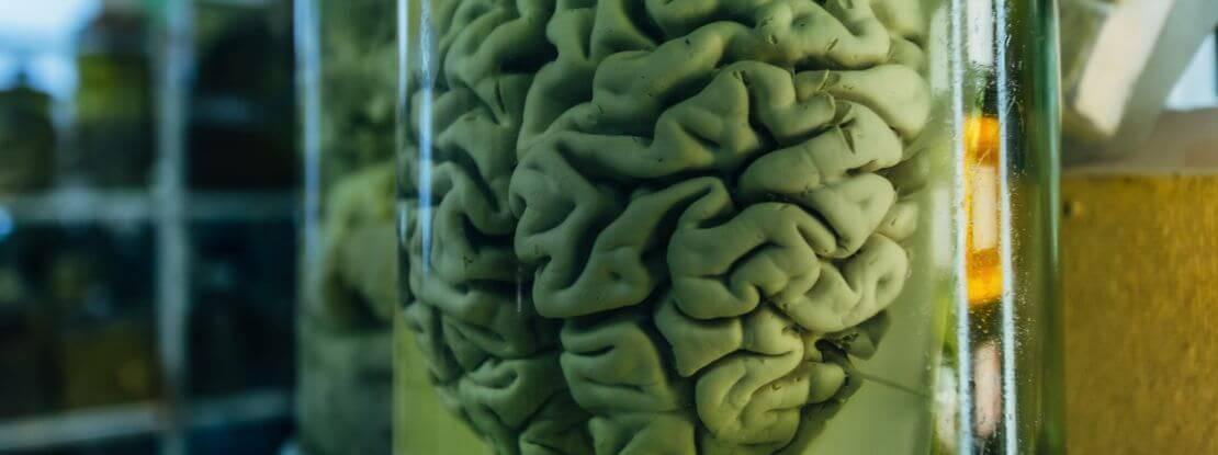 Au Danemark, une collection de presque 10 000 cerveaux, prélevés sur les cadavres des patients des HP