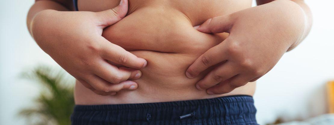 47% des Français sont en surpoids, dont 17% obèses