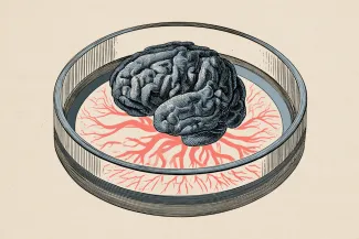 organoïdes cérébraux glioblastome (1).png